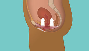 wow-l2-bladder-and-pelvic-floor-problems-id10097-01.jpg